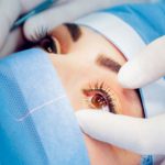 Glaucoma Services